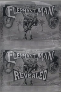 The Terrible Elephant Man Revealed 2001 on netflix