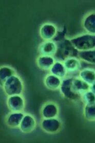 ERYTHROPOIEISIS AND ERYTHROPOIETIN 1989 on netflix