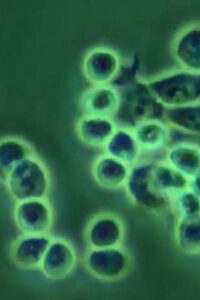 ERYTHROPOIEISIS AND ERYTHROPOIETIN 1989 on netflix