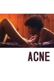 Acne 2008 on netflix