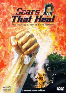 Scars That Heal: The Dave Roever Story 1993 on netflix