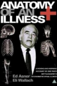 Anatomy of an Illness 1984 on netflix
